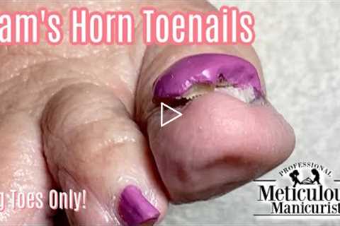 👣Big Toes Only - Pedicure How to on Impacted Ram's Horn Toenails - RIGHT FOOT👣