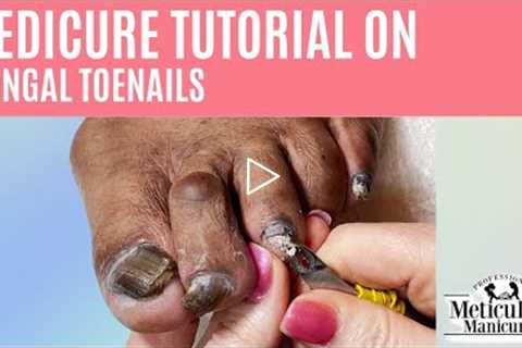 👣How to Pedicure on Thick Dark Big Toenails with Nail Fungus👣