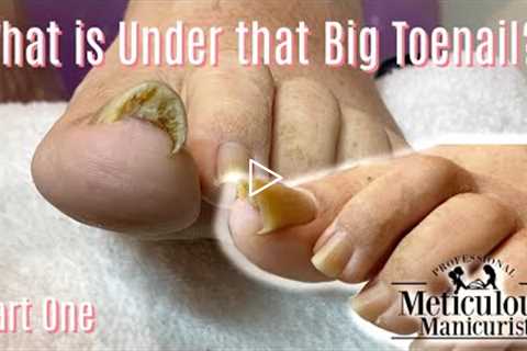 👣 Take Care of Your Toenail Pain at Home Online Ingrown Pedicure Lesson 👣