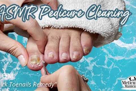 👣ASMR Pedicure Cleaning💆‍♀️Thick Toenails Remedy👣
