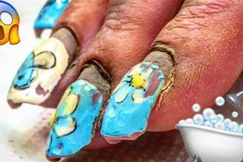 #TRANSFORMATION of #HARDWORKER WOMAN’S NAILS SOME DAYS BEFORE CHILD DELIVERY
