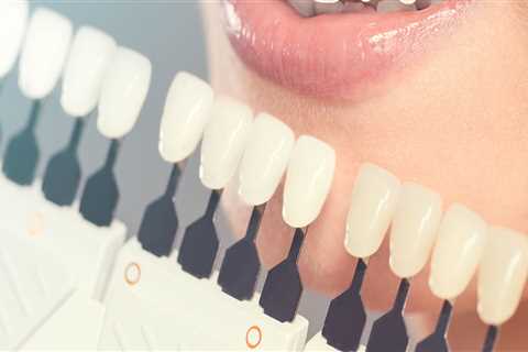 What is the Scope of Cosmetic Dentistry