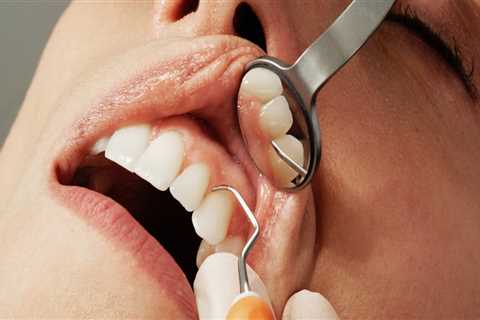 What are the Benefits Dental Health