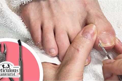 Thorough Pedicure Toenail Cleaning #nails #satisfying