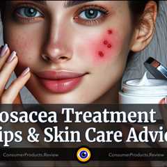 Rosacea Treatment Tips & Skin Care Advice